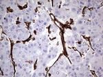 VIM Antibody in Immunohistochemistry (Paraffin) (IHC (P))