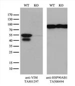 VIM Antibody