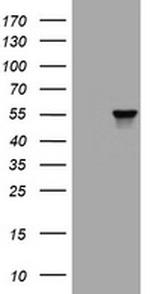 VIM Antibody in Western Blot (WB)