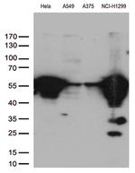 VIM Antibody in Western Blot (WB)