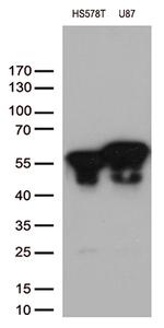 VIM Antibody in Western Blot (WB)