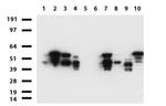 VIM Antibody in Western Blot (WB)