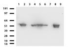 VIM Antibody in Western Blot (WB)