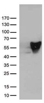 VIM Antibody in Western Blot (WB)