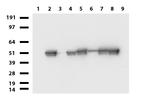 VIM Antibody in Western Blot (WB)