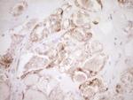 VIP Antibody in Immunohistochemistry (Paraffin) (IHC (P))