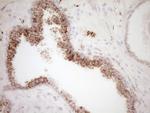 VIP Antibody in Immunohistochemistry (Paraffin) (IHC (P))