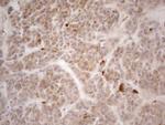 VIP Antibody in Immunohistochemistry (Paraffin) (IHC (P))