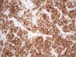 VIP Antibody in Immunohistochemistry (Paraffin) (IHC (P))