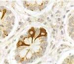 VPAC2 Antibody in Immunohistochemistry (IHC)