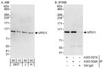 VPS11 Antibody in Western Blot (WB)