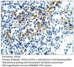 VPS26 Antibody in Immunohistochemistry (IHC)