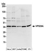 VPS26A Antibody in Western Blot (WB)