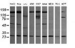 VPS28 Antibody in Western Blot (WB)