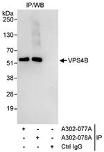 VPS4B Antibody in Immunoprecipitation (IP)