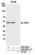 VRK1 Antibody in Western Blot (WB)