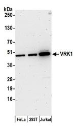 VRK1 Antibody in Western Blot (WB)