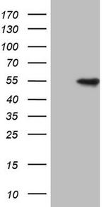 VRK1 Antibody in Western Blot (WB)