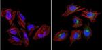 VRK1 Antibody in Immunocytochemistry (ICC/IF)