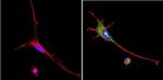 VRK1 Antibody in Immunocytochemistry (ICC/IF)