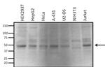 VRK1 Antibody in Western Blot (WB)