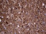 VSNL1 Antibody in Immunohistochemistry (Paraffin) (IHC (P))