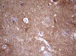 VSNL1 Antibody in Immunohistochemistry (Paraffin) (IHC (P))