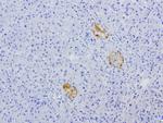 VSNL1 Antibody in Immunohistochemistry (Paraffin) (IHC (P))