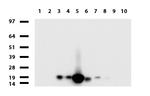 VSNL1 Antibody in Western Blot (WB)