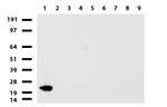 VSNL1 Antibody in Western Blot (WB)