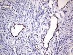 VWF Antibody in Immunohistochemistry (Paraffin) (IHC (P))