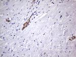 VWF Antibody in Immunohistochemistry (Paraffin) (IHC (P))