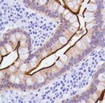 Villin Antibody in Immunohistochemistry (Paraffin) (IHC (P))