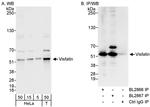 NAMPT/PBEF/Visfatin Antibody in Western Blot (WB)