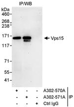 Vps15 Antibody in Immunoprecipitation (IP)