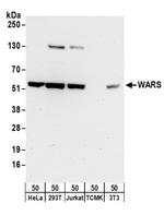 WARS Antibody in Western Blot (WB)