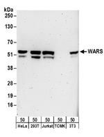 WARS Antibody in Western Blot (WB)