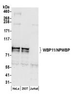 WBP11/NPWBP Antibody in Western Blot (WB)