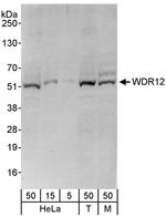 WDR12 Antibody in Western Blot (WB)