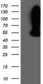 WDR4 Antibody in Western Blot (WB)