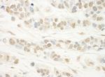 WDR5 Antibody in Immunohistochemistry (IHC)