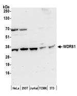 WDR61/REC14/SKI8 Antibody in Western Blot (WB)