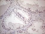 WDR61 Antibody in Immunohistochemistry (Paraffin) (IHC (P))