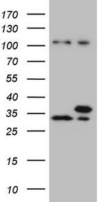 WDR61 Antibody in Western Blot (WB)