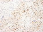 WDR77/MEP50 Antibody in Immunohistochemistry (IHC)