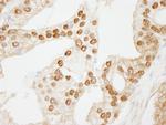 WDR77/MEP50 Antibody in Immunohistochemistry (IHC)