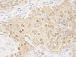 WDR77/MEP50 Antibody in Immunohistochemistry (IHC)