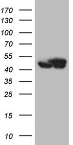 WDR77 Antibody in Western Blot (WB)