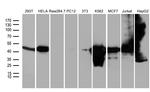 WDR77 Antibody in Western Blot (WB)