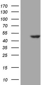 WDR77 Antibody in Western Blot (WB)